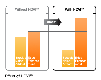 A HD Volume Imaging (HDVI) képalkotás hatása 